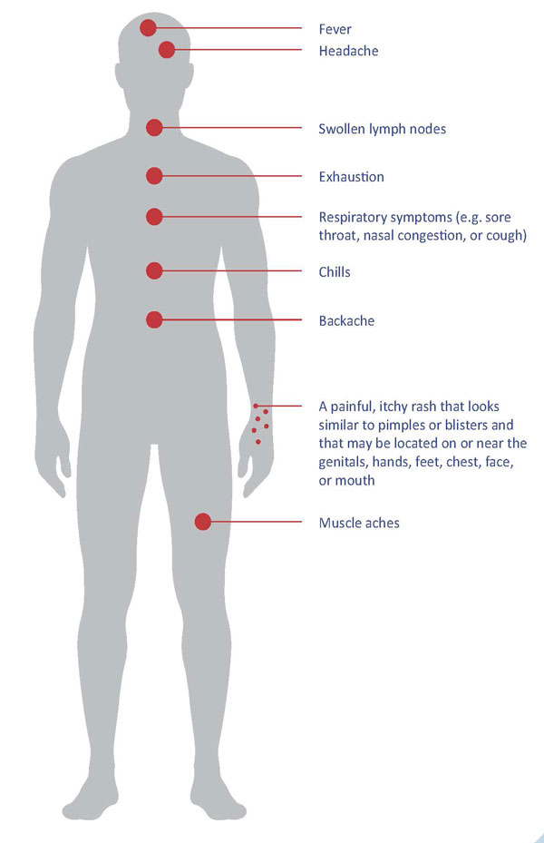 Monkeypox info graphic